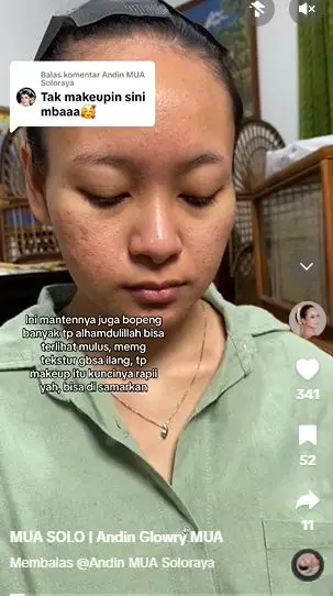 Transformasi cewek wajah bopeng usai dirias jadi pengantin bikin pangling TikTok