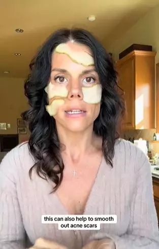 Umbi-umbian bisa pudarkan flek hitam dan bekas jerawat membandel di wajah Berbagai sumber Umbi-umbian bisa pudarkan flek hitam dan bekas jerawat membandel di wajah Berbagai sumber