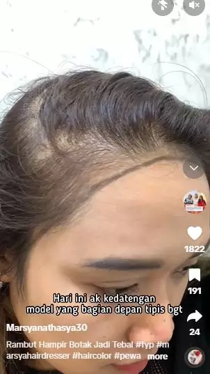 Perubahan cewek rambut super tipis usai di styling hasilnya bak pakai wig TikTok Perubahan cewek rambut super tipis usai di styling hasilnya bak pakai wig TikTok