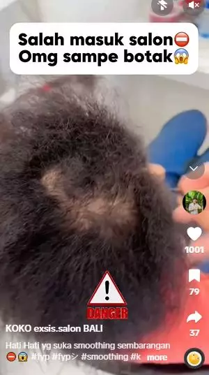 Perubahan rambut cewek kribo dan botak jadi bak punya rambut baru TikTok Perubahan rambut cewek kribo dan botak jadi bak punya rambut baru TikTok