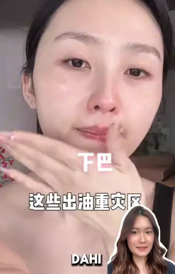 Trik hilangkan bintik-bintik kecil mirip komedo di wajah TikTok Trik hilangkan bintik-bintik kecil mirip komedo di wajah TikTok