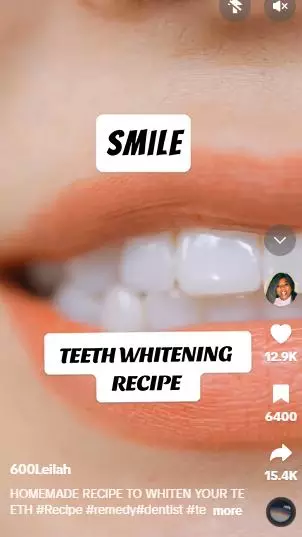 Trik atasi gigi kuning pakai pasta gigi dicampur 3 bahan dapur Berbagai sumber