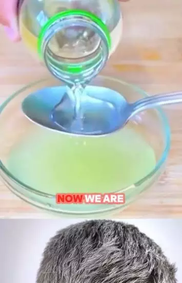 Cara mengurangi tumbuhnya uban pakai lemon dicampur 1 jenis minyak Berbagai sumber Cara mengurangi tumbuhnya uban pakai lemon dicampur 1 jenis minyak Berbagai sumber