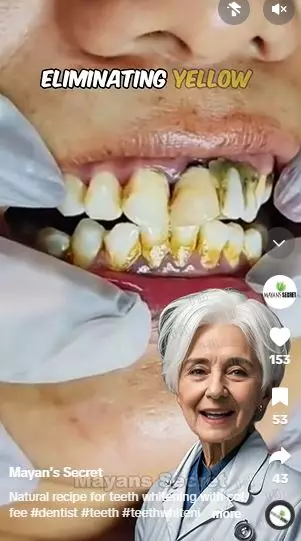 Cara atasi gigi bernoda kuning pakai 1 bahan minuman Berbagai sumber