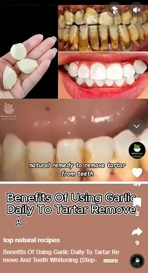 Bawang putih dicampur 1 jenis buah bisa atasi gigi bernoda kuning Berbagai sumber