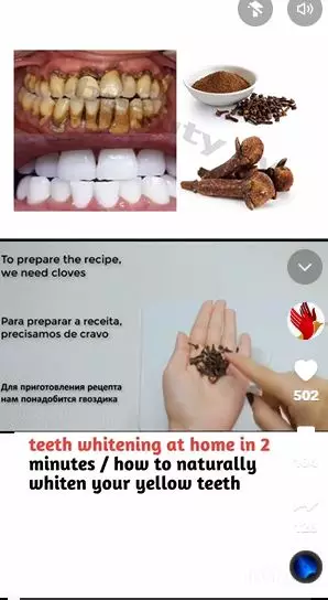 Campuran cengkeh dan 1 jenis buah bisa pudarkan gigi kuning Berbagai sumber