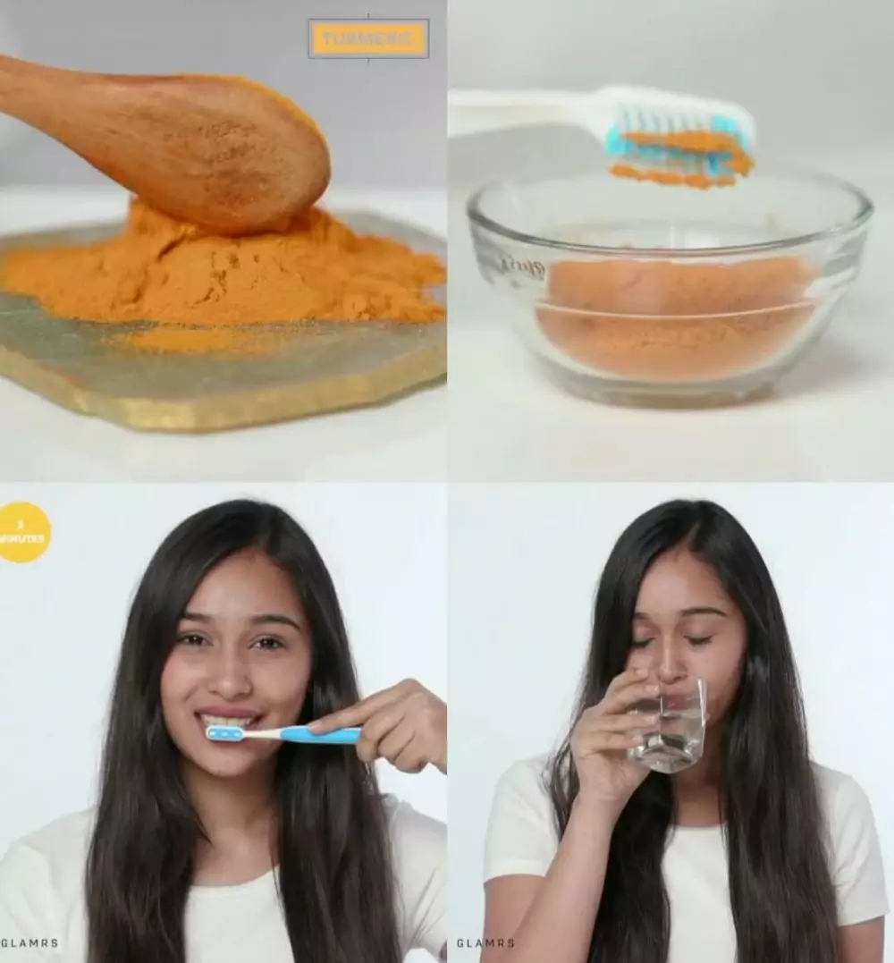 mengikis noda kuning pada gigi © Instagram mengikis noda kuning pada gigi © Instagram