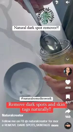 Kombinasi baking soda dan 1 jenis minyak ampuh pudarkan flek hitam di wajah Berbagai sumber