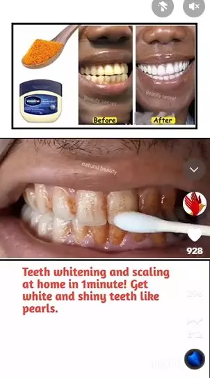 Campuran petroleum jelly dan 1 bahan dapur efektif putihkan gigi kuning Berbagai sumber