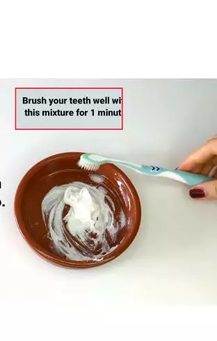 Campuran petroleum jelly dan 1 bahan dapur efektif putihkan gigi kuning Berbagai sumber