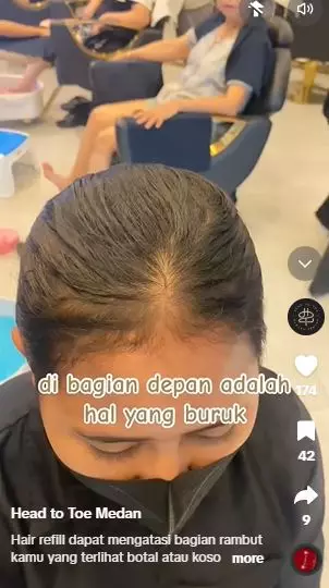 Transformasi cewek botak depan usai di styling hasilnya bak beda orang TikTok Transformasi cewek botak depan usai di styling hasilnya bak beda orang TikTok