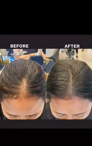 Transformasi cewek botak depan usai di styling hasilnya bak beda orang TikTok Transformasi cewek botak depan usai di styling hasilnya bak beda orang TikTok