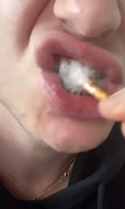 Putihkan gigi kekuningan dengan 1 jenis ranting pohon Berbagai sumber Putihkan gigi kekuningan dengan 1 jenis ranting pohon Berbagai sumber