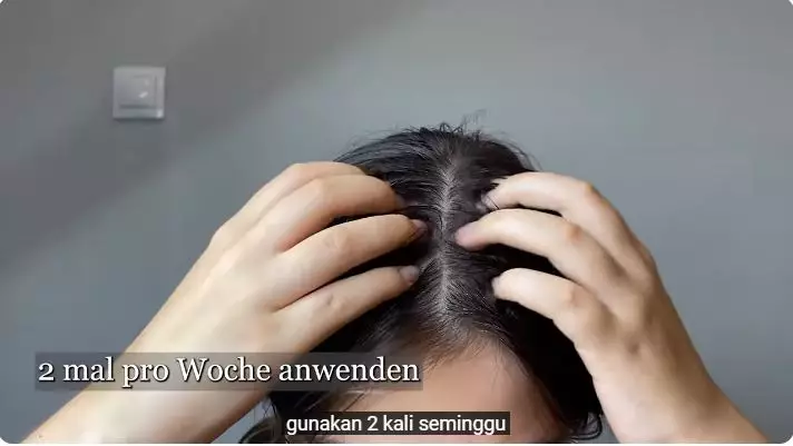 cara atasi rambut rontok berlebihan karena stres berbagai sumber