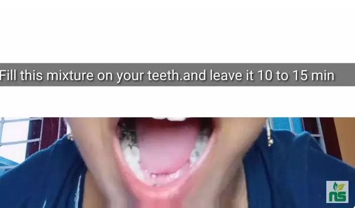 trik hilangkan gigi hitam agar kembali putih berbagai sumber trik hilangkan gigi hitam agar kembali putih berbagai sumber