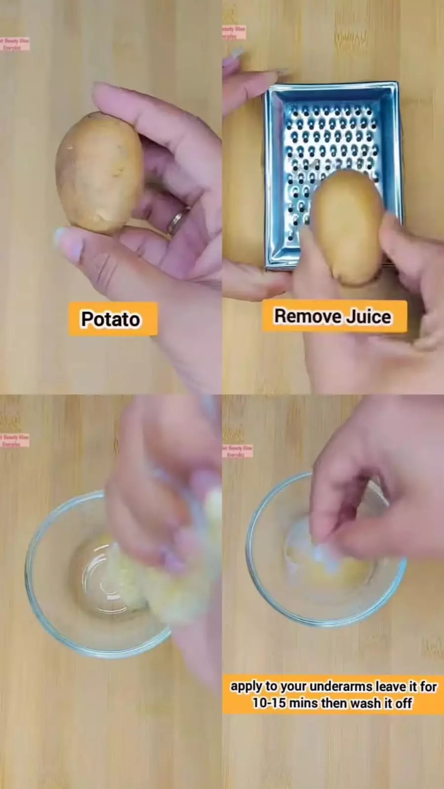 putihkan ketiak hitam dan penuh daki © Instagram