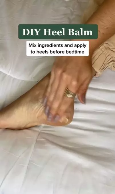 Haluskan tumit retak dan kasar pakai 2 jenis minyak Berbagai sumber Haluskan tumit retak dan kasar pakai 2 jenis minyak Berbagai sumber