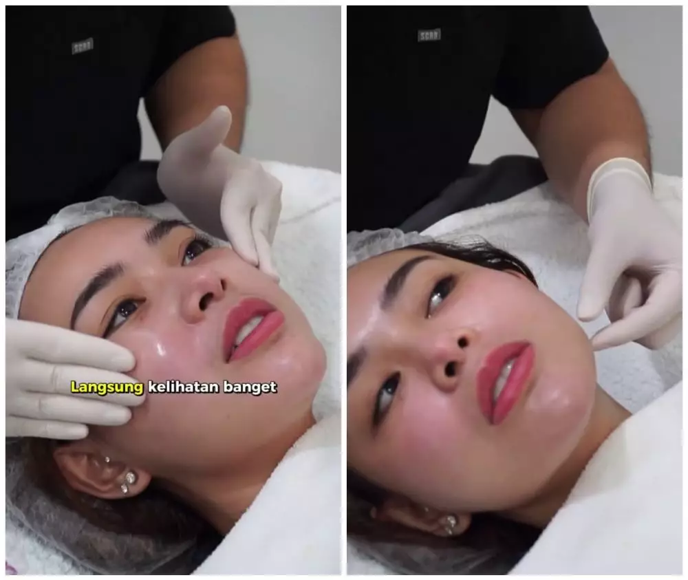 cara Amanda Manopo lakukan perawatan wajah © Instagram cara Amanda Manopo lakukan perawatan wajah © Instagram