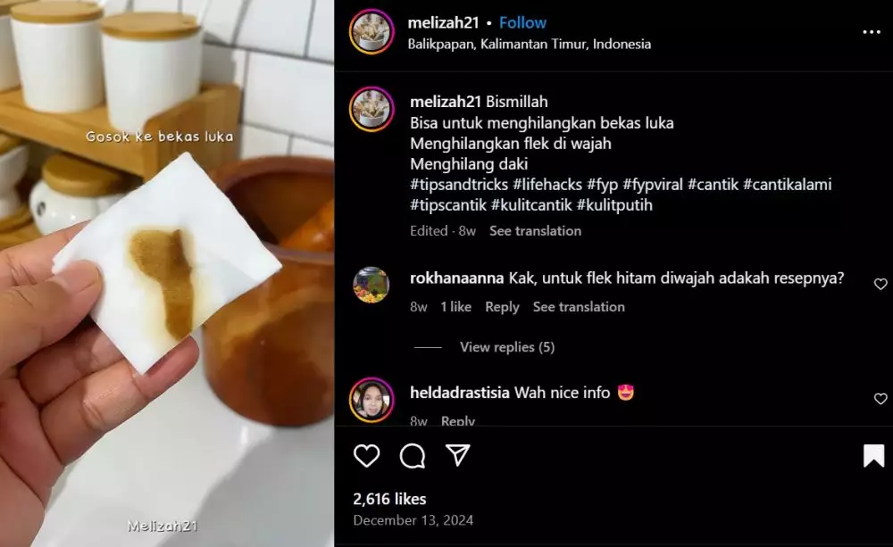 cara menghilangkan bekas luka secara alami © Instagram