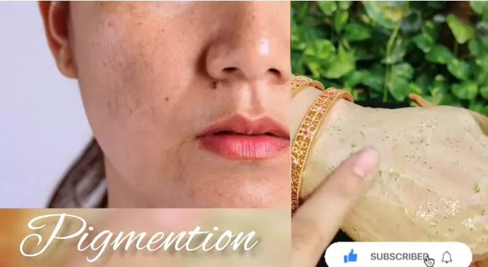 cara cerahkan flek hitam di wajah berbagai sumber