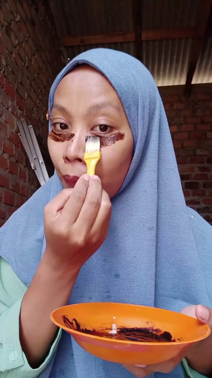 cara mengatasi kantung mata kendur © Instagram