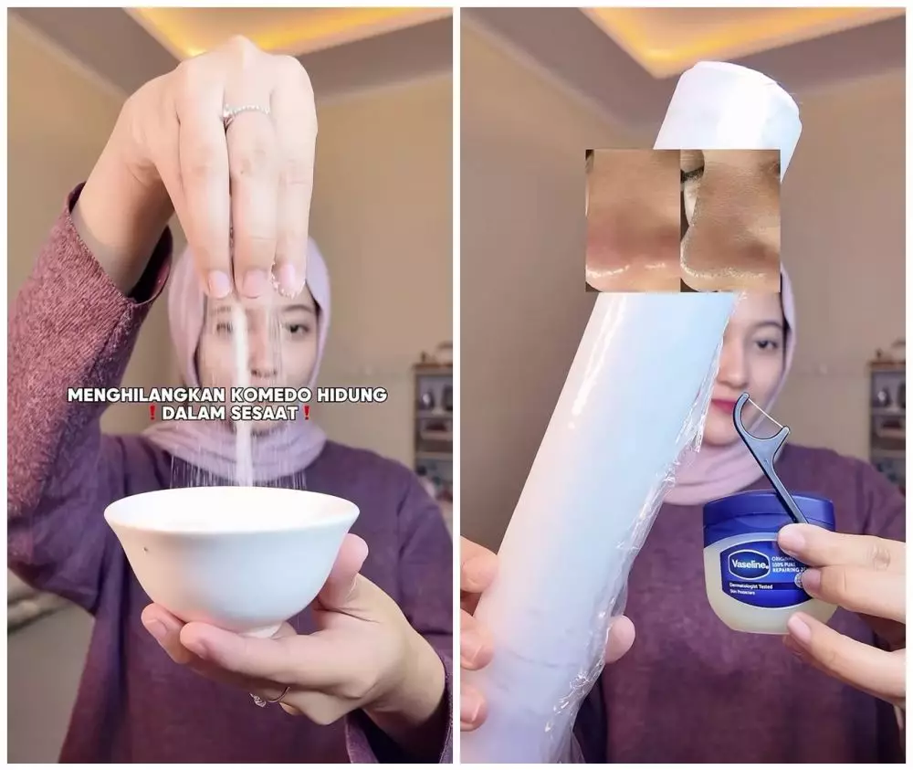 cara hempaskan komedo dalam 10 menit © Instagram