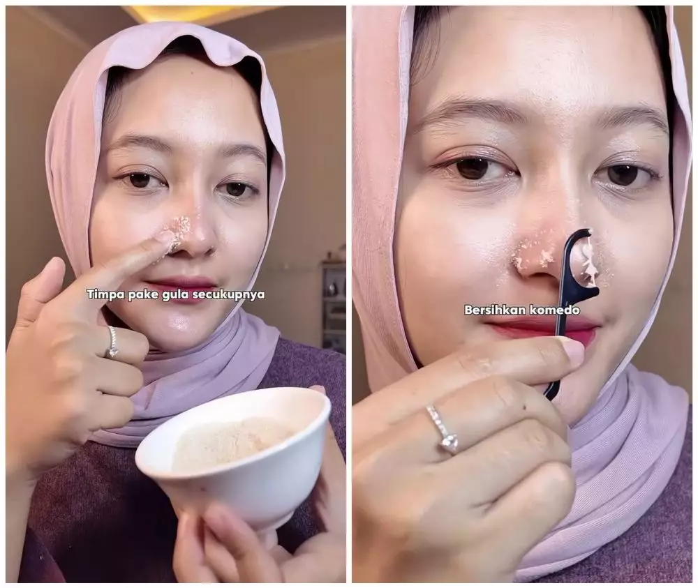 cara hempaskan komedo dalam 10 menit © Instagram