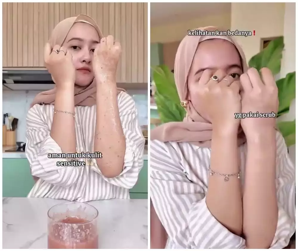 cara memutihkan kulit tangan agar tak belang © Instagram