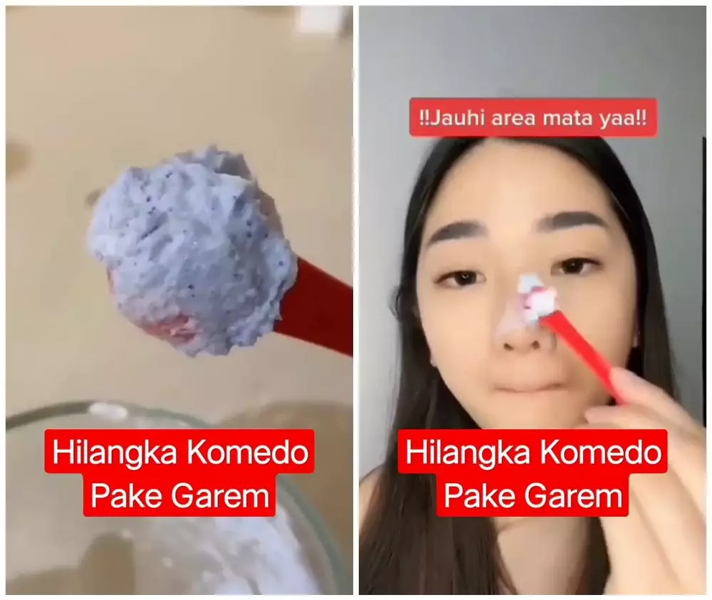 cara menghilangkan komedo membandel © YouTube