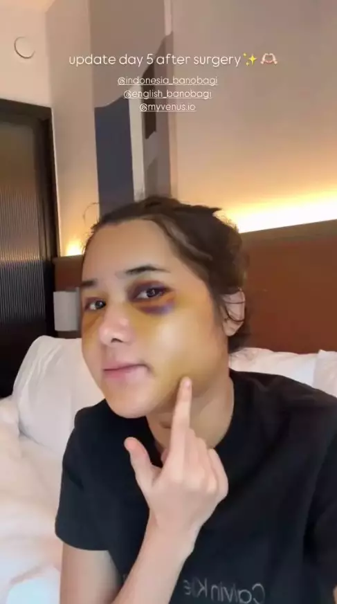 wajah baru Dilan Janiyar © 2025 brilio.net wajah baru Dilan Janiyar © 2025 brilio.net