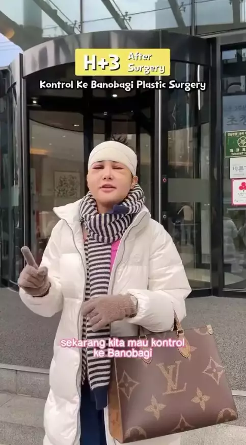 wajah baru Dilan Janiyar © 2025 brilio.net wajah baru Dilan Janiyar © 2025 brilio.net