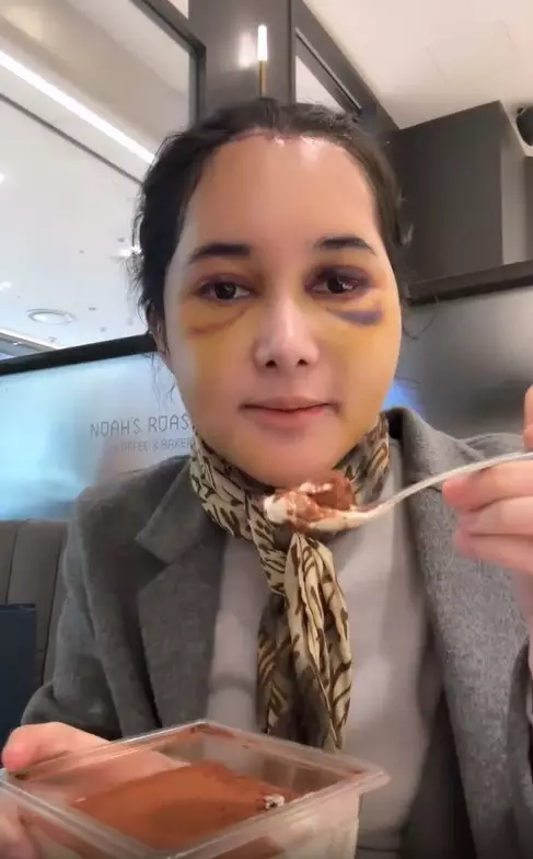 wajah baru Dilan Janiyar © 2025 brilio.net wajah baru Dilan Janiyar © 2025 brilio.net