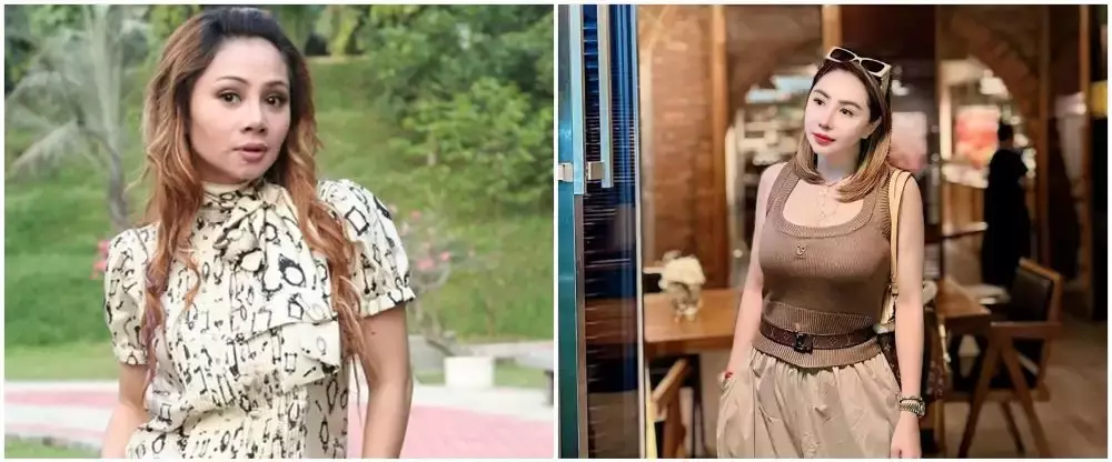 rewrite 25 seleb operasi plastik © 2025 brilio.net