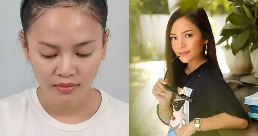 rewrite 25 seleb operasi plastik © 2025 brilio.net