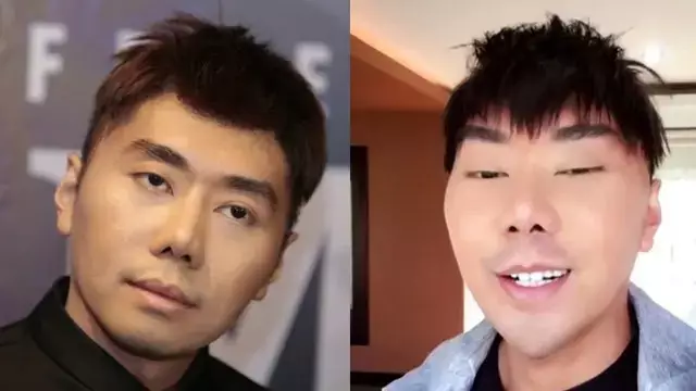 15 potret wajah seleb oplas dagu © 2025 brilio.net