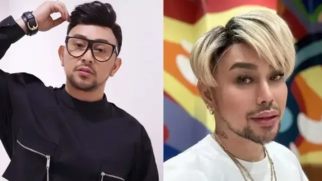 15 potret wajah seleb oplas dagu © 2025 brilio.net