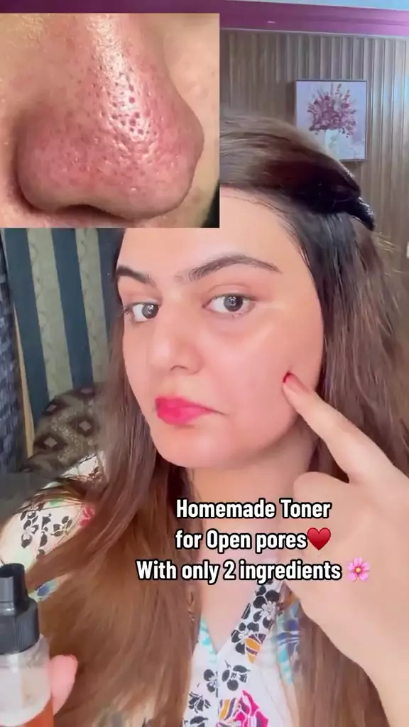 cara kecilkan pori-pori besar (stok) © TikTok