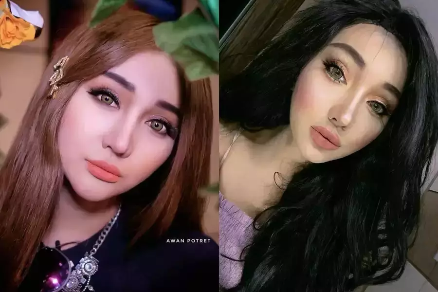 seleb sebelum dan setelah lakukan filler bibir (stok) © 2025 brilio.net seleb sebelum dan setelah lakukan filler bibir (stok) © 2025 brilio.net