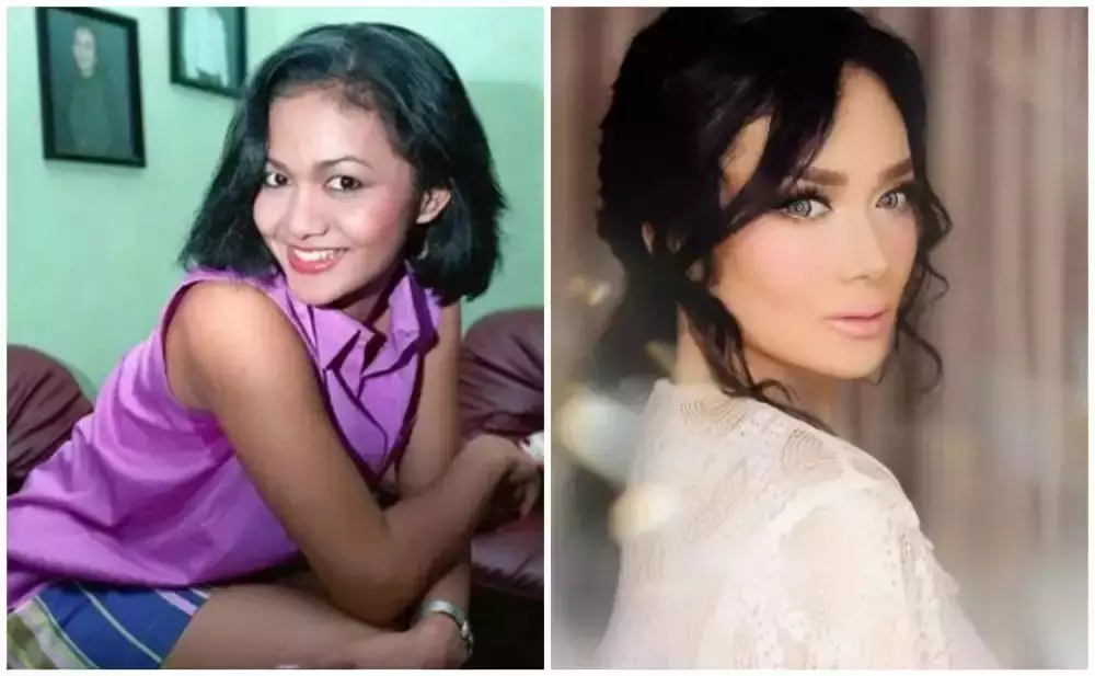 seleb sebelum dan setelah lakukan filler bibir (stok) © 2025 brilio.net seleb sebelum dan setelah lakukan filler bibir (stok) © 2025 brilio.net