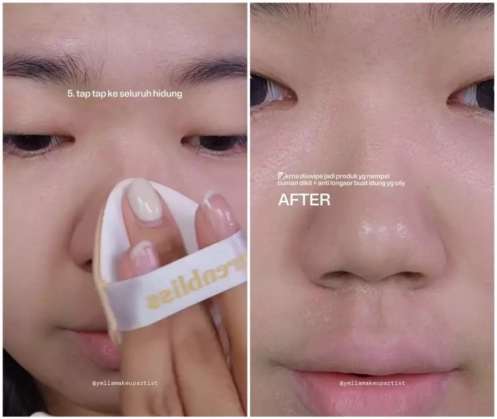 Pori-pori tampak bolong © Instagram