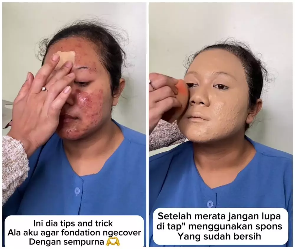 Transformasi makeup wanita berjerawat © TikTok