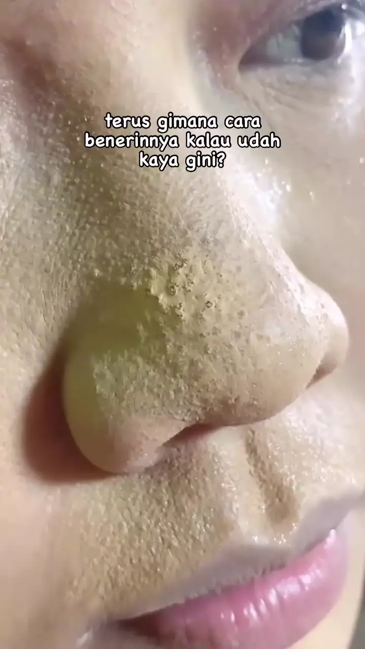 Complexion berlubang © Instagram Complexion berlubang © Instagram