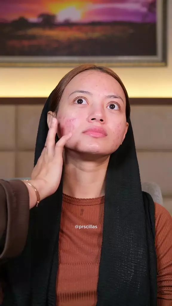 makeup wanita punya jerawat aktif © TikTok