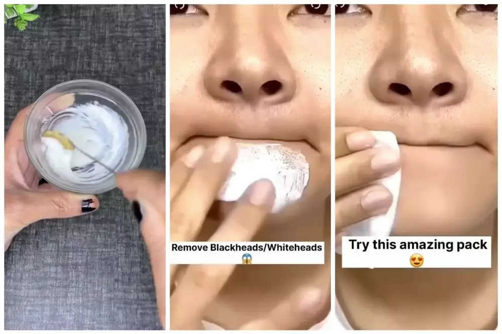 cara hilangkan komedo hitam dan bruntusan © Instagram 