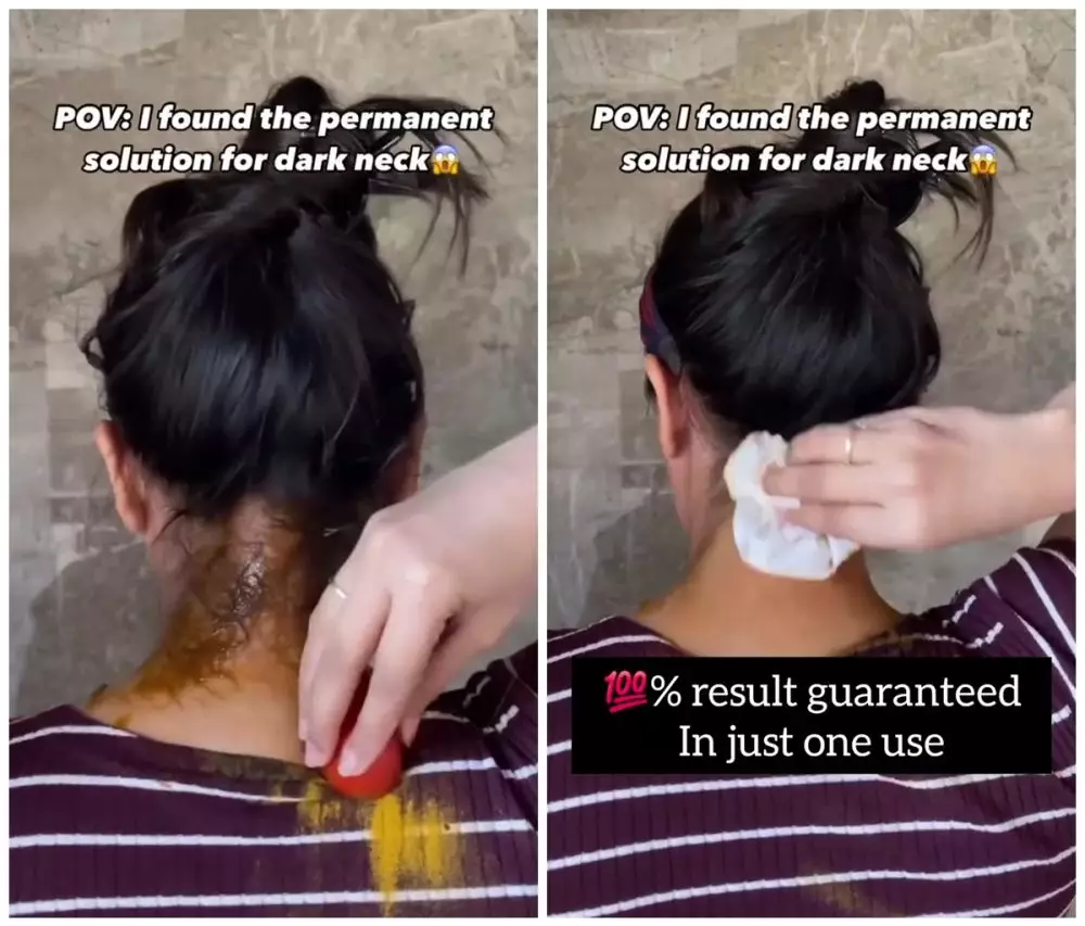 Cara eksfoliasi punggung leher © Instagram  Cara eksfoliasi punggung leher © Instagram