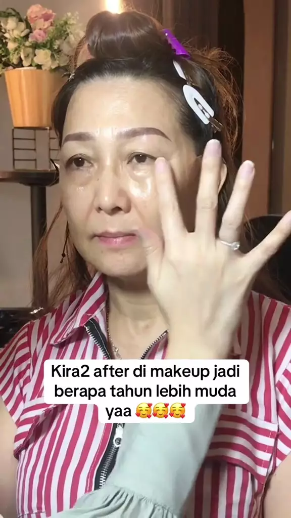 Mata sayu akibat kulit kendur © TikTok