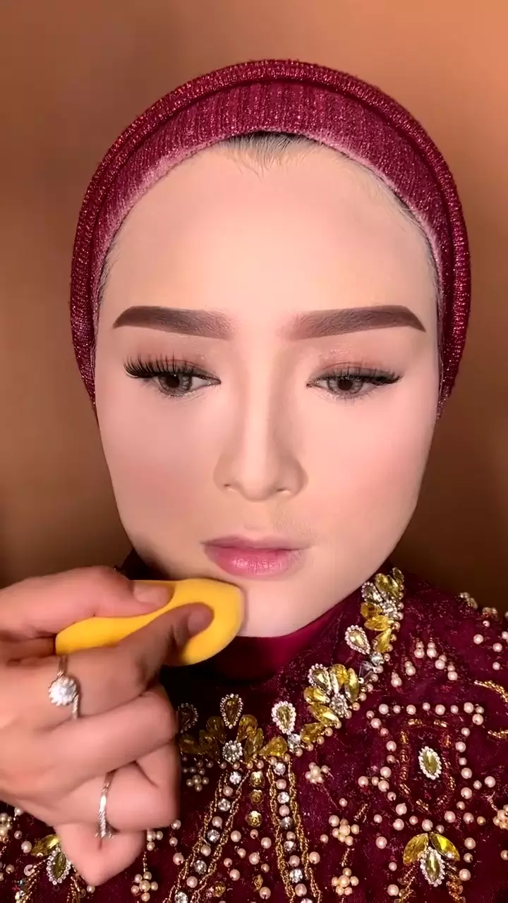Wajah kemerahan akibat jerawat © Instagram Wajah kemerahan akibat jerawat © Instagram