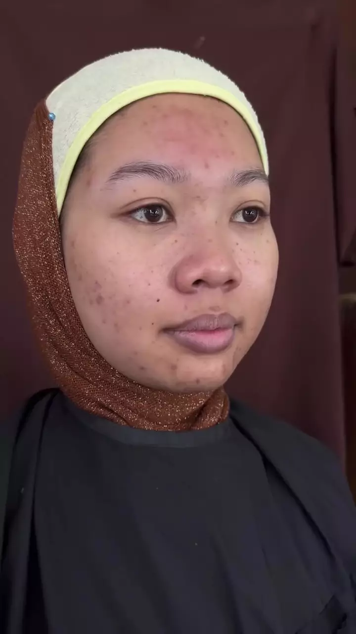 transformasi makeup cewek berjerawat dirias fresh © Instagram transformasi makeup cewek berjerawat dirias fresh © Instagram