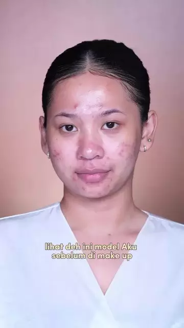 Kulit berminyak dan jerawatan dirias © Instagram