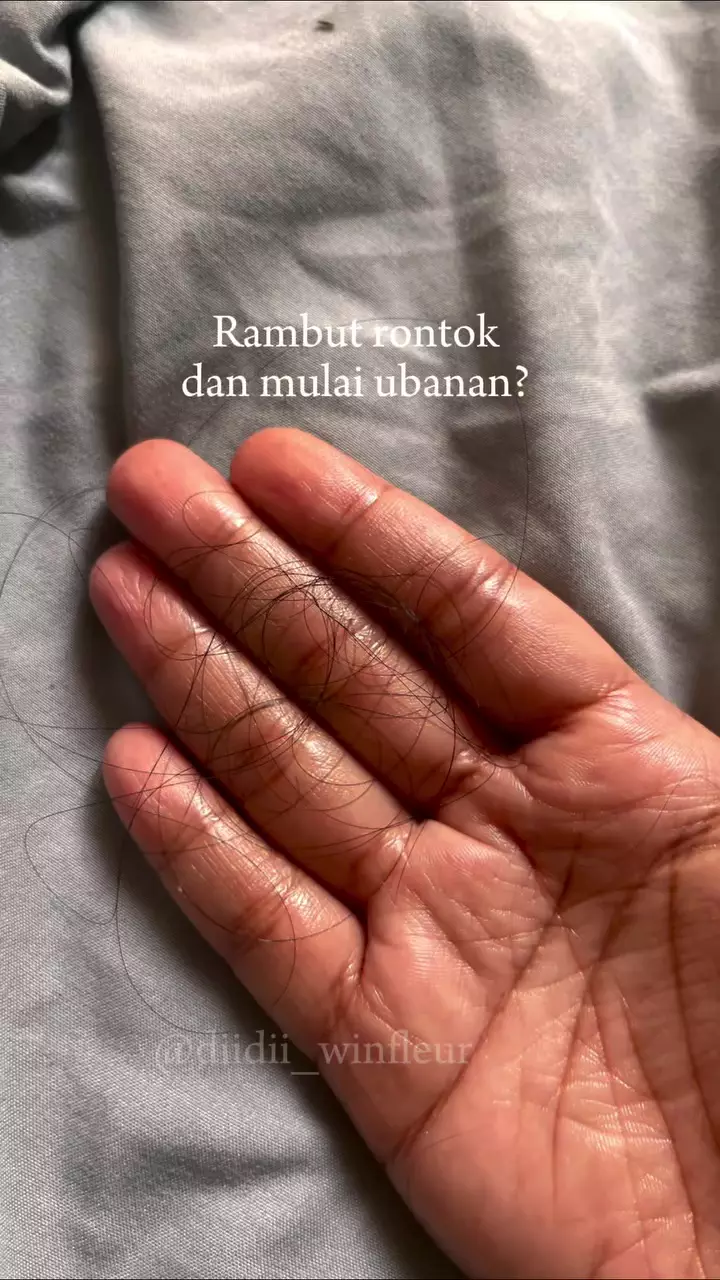 cara cegah rambut rontok dan uban © Instagram